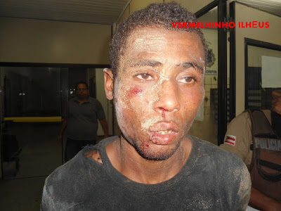 Essa foi a 2ª vez que “Dente” foi capturado e espancado por populares