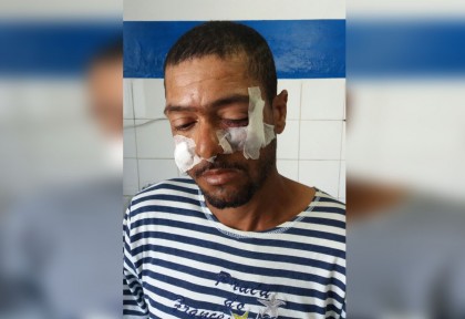 Homem sofreu ferimentos no rosto (Foto: Ubatã Notícias)