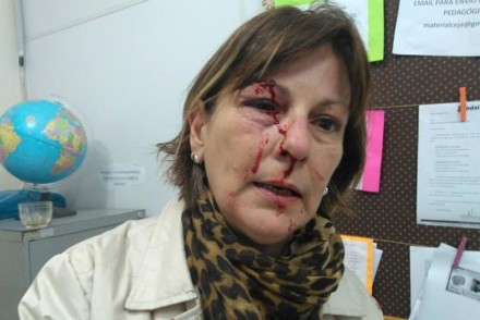 Professora foi agredida após chamar atenção de aluno (Foto: Divulgação)