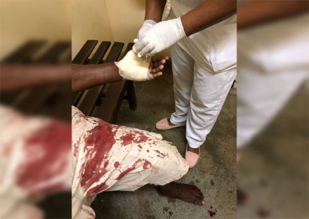 Homem foi atingido no braço por golpe de facão (Foto: Ubatã Notícias)
